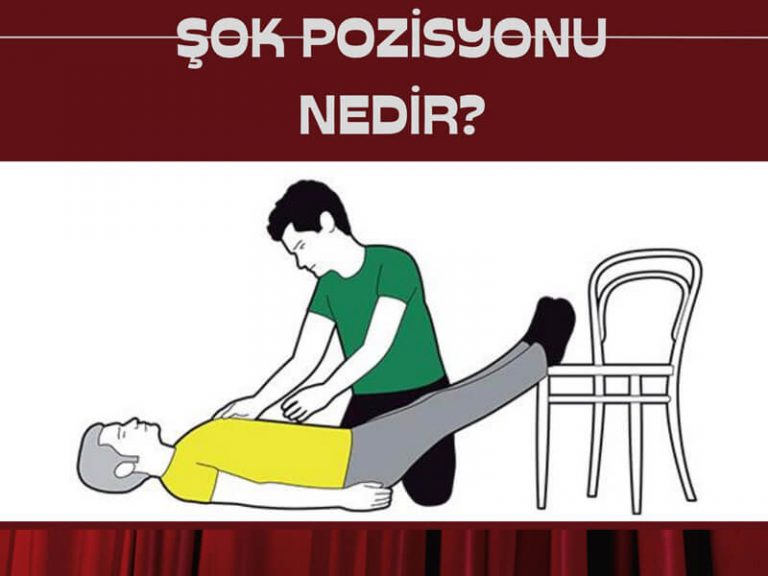 Şok Pozisyonu
